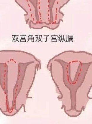 福建排名第一的试管医院，福建试管医院排行榜